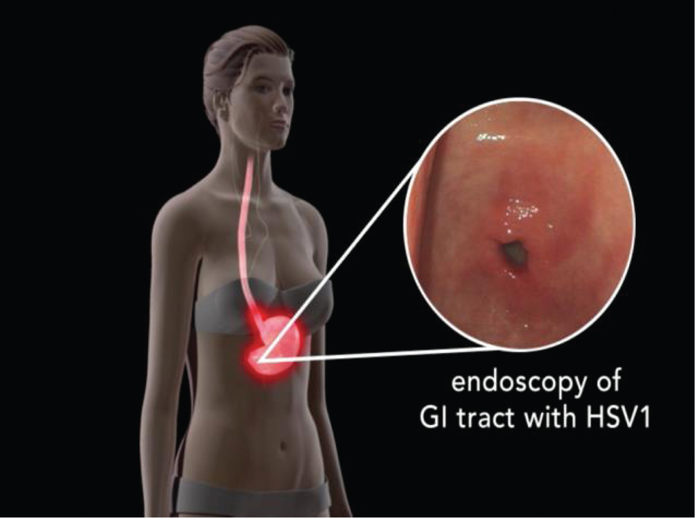 [MISSING IMAGE: tm2025286d1-ph_endoscop4clr.jpg]